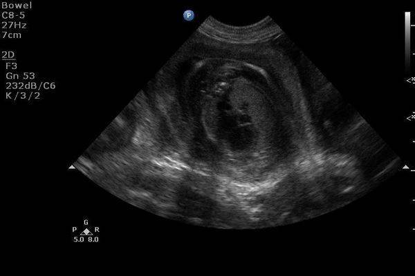 Echographie d'une chienne en gestation